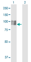 H00006490-B01P - Melanoma gp100