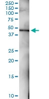 H00006502-D01 - SKP2 / FBXL1
