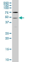 H00006517-A01 - GLUT4 / SLC2A4