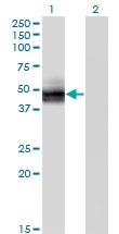 H00006517-M02 - GLUT4 / SLC2A4
