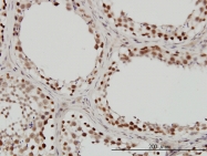 H00006598-M01 - SMARCB1