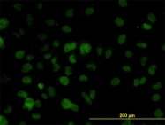 H00006603-M01 - SMARCD2