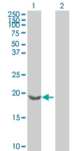 H00006620-B01P - Beta-Synuclein / SCNB