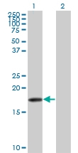 H00006620-M07 - Beta-Synuclein / SCNB