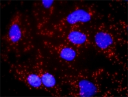 H00006622-D01P - Alpha-Synuclein / SNCA