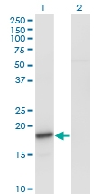 H00006622-M01 - Alpha-Synuclein / SNCA