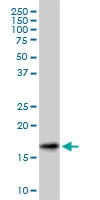 H00006623-M01A - Gamma-Synuclein / SNCG