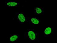 H00006626-B01P - U1 snRNP protein A