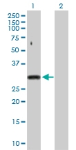 H00006626-D01P - U1 snRNP protein A