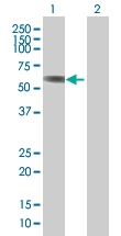 H00006640-B01 - Syntrophin-1 / SNTA1