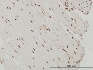 H00006667-M03 - SP1 / TSFP1