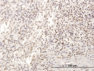 H00006672-B01 - SP100