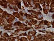 H00006690-M01 - SPINK1