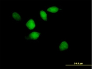 H00006693-B01P - CD43 / Leukosialin