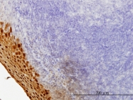 H00006707-M01 - SPRR3 / Cornifin beta