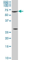 H00006722-M03 - Serum response factor (SRF)