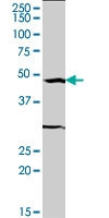 H00006722-M04 - Serum response factor (SRF)