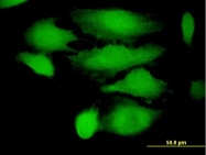 H00006737-B01P - SS-A / Ro52 / TRIM21