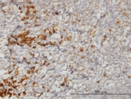 H00006745-M01 - SSR1 / TRAPA