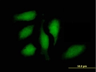 H00006772-B01P - STAT1