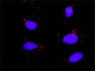 H00006774-M01 - STAT3