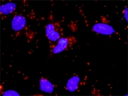 H00006774-M02 - STAT3