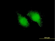 H00006775-B01 - STAT4