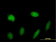 H00006776-B01 - STAT5 / STAT5A