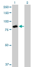 H00006776-D01P - STAT5 / STAT5A