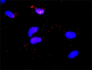 H00006776-D01P - STAT5 / STAT5A