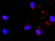 H00006776-D01P - STAT5 / STAT5A