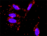 H00006776-M02 - STAT5 / STAT5A