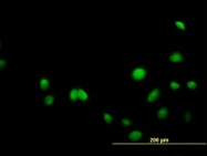 H00006777-B01 - STAT5B