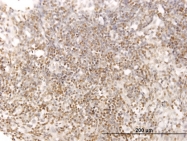 H00006777-M02 - STAT5B