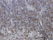 H00006777-M03 - STAT5B