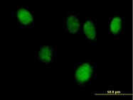 H00006778-B01 - STAT6