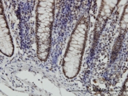 H00006778-M01 - STAT6