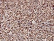H00006786-M01 - STIM1 / GOK