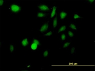 H00006788-B01 - STK3
