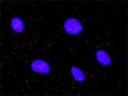 H00006789-M02 - STK4