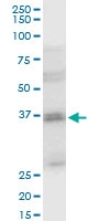 H00006810-A01 - Syntaxin 4 / STX4