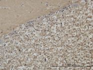 H00006812-M01 - STXBP1 / UNC18A