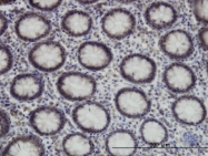 H00006829-M01 - SUPT5H