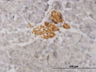 H00006843-M02 - VAMP-1 / Synaptobrevin-1
