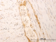 H00006857-M05 - Synaptotagmin-1