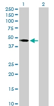 H00006862-D01P - T (Brachyury protein)