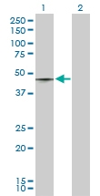 H00006862-D03P - T (Brachyury protein)