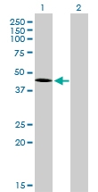 H00006862-M01 - T (Brachyury protein)