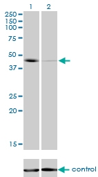 H00006862-M01 - T (Brachyury protein)