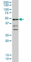 H00006862-M02 - T (Brachyury protein)